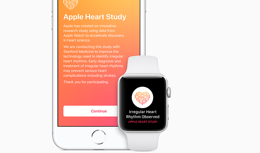 苹果发布首个用于心脏研究的Apple Watch应用程序